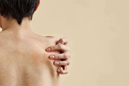 What's The Best Soap For Eczema & Sensitive Skin? - INÉ